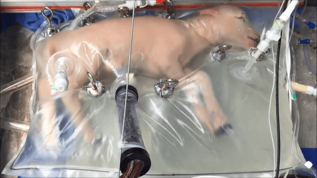 Ectogenesis: artificial wombs