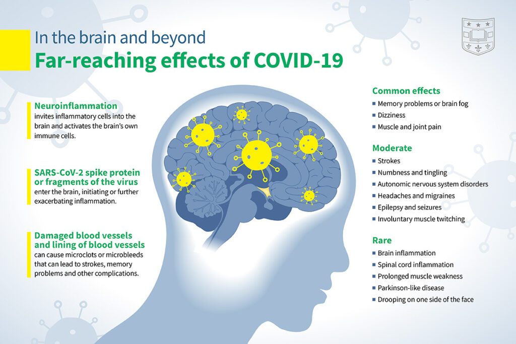 COVID-19 infections increase risk of long-term brain problems (medicine.wustl.edu)